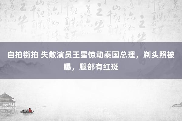 自拍街拍 失散演员王星惊动泰国总理，剃头照被曝，腿部有红斑